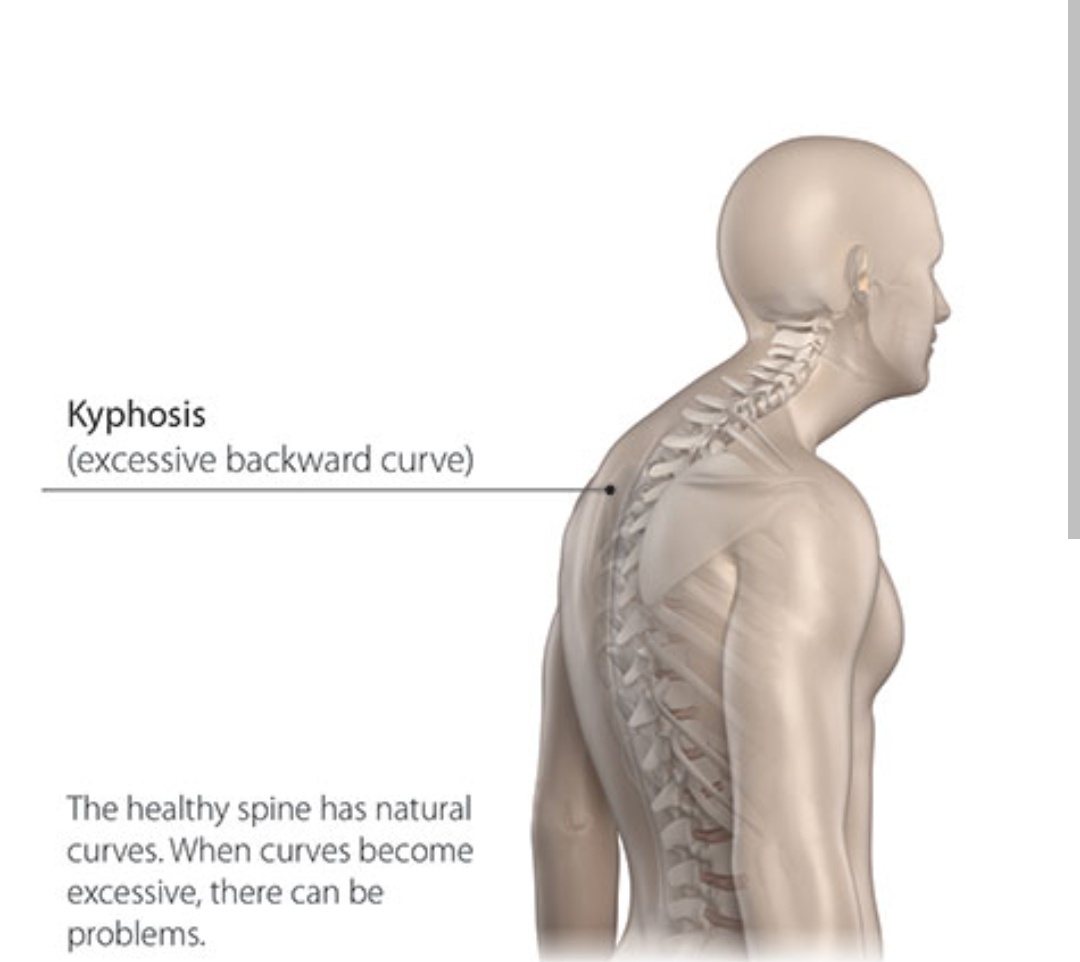 Thyroid Disorders